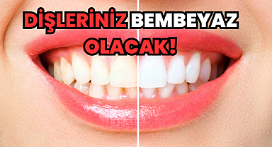 Dişleriniz Bembeyaz Olacak!