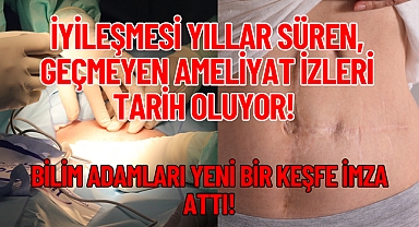 İyileşmesi Yıllar Süren, Geçmeyen Ameliyat İzleri Tarih Oluyor! 