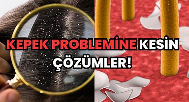 Kepek Problemine Kesin Çözümler!